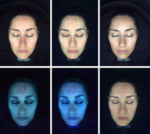 Triemer Aeshetics Dresden Kosmetik Kosmetikbehandlung Haut Hautanalyse Observe SkinScope